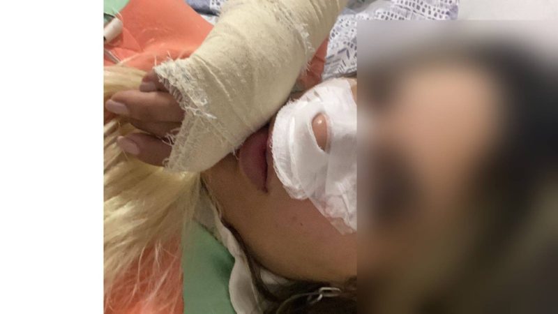 Dentista que denunciou ter sido agredida por seguranças de bar a mando de marido pede medidas protetivas
