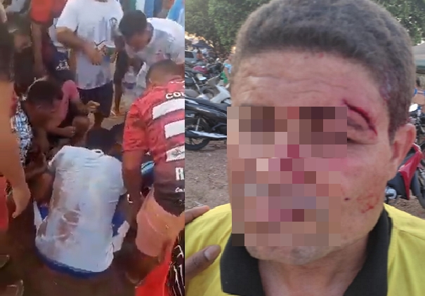 Árbitro é atingido por garrafa no rosto durante torneio de futebol amador