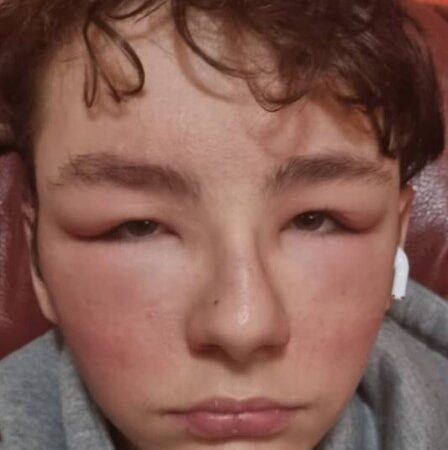 Adolescente é levado à emergência de hospital após ‘reação alérgica’ a óculos de realidade virtual do Facebook