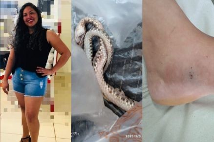 Mulher que morreu ao ser picada por cobra recebeu soro antiofídico, diz médico