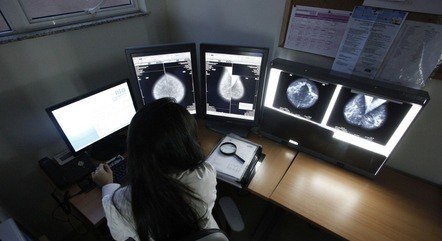 Médicos conseguem eliminar câncer de mama agressivo sem quimioterapia