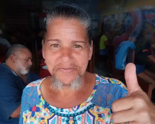 Mulher assume condição genética e deixa barba crescer: ‘Precisava me sentir completa’